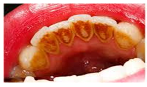 periodontoloji1.PNG