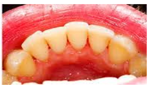 periodontoloji2.PNG